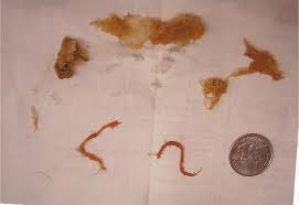 Parasites - Intestinal